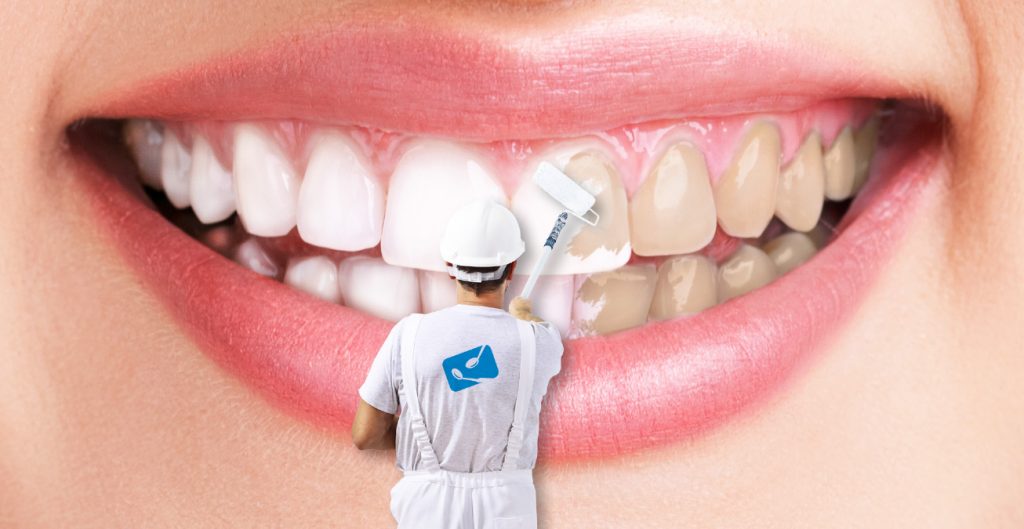 Auckland frecuencia Con fecha de Qué hacer para tener dientes más blancos - Clínicas Dentales Corró Maduro -  Panamá